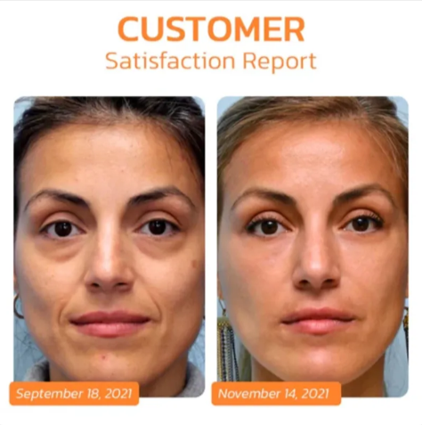 Mascarilla Ocular Soluble de Colágeno – Reafirmante e Hidratante