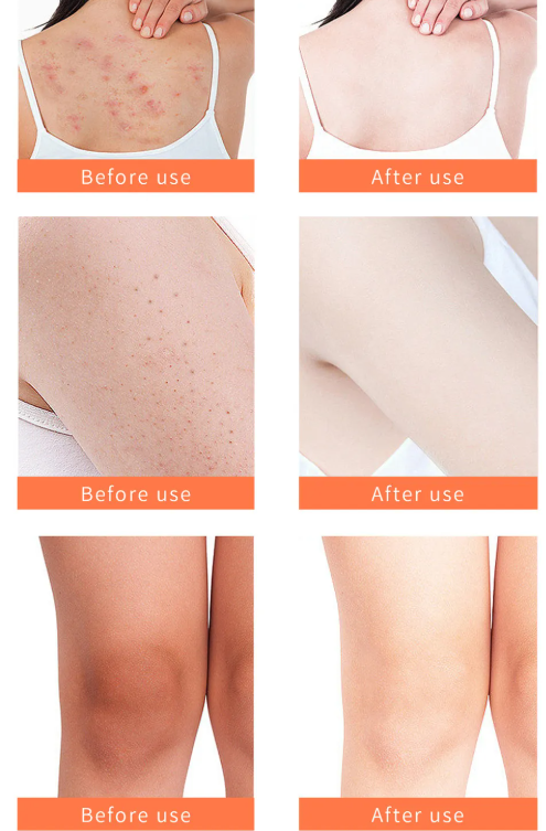 Exfoliante Corporal de Cúrcuma