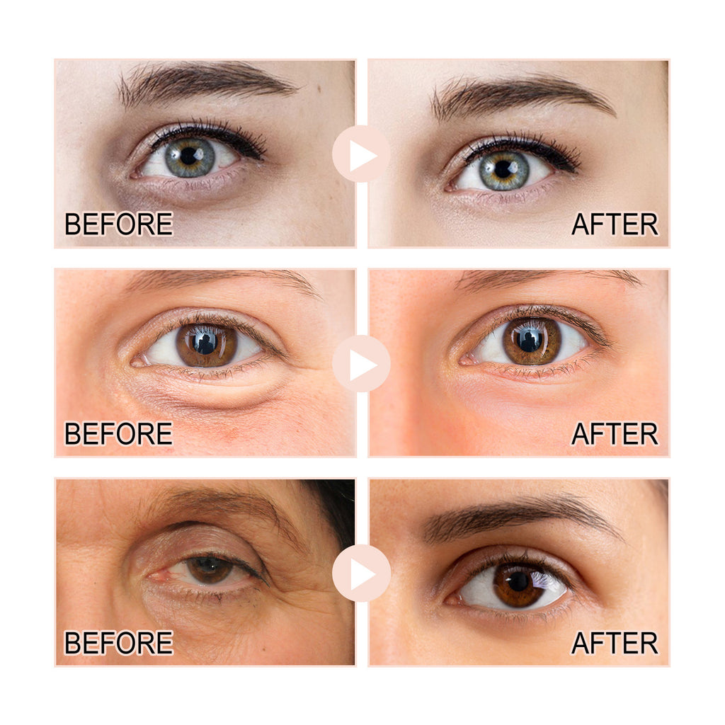 Crema para las Arrugas del Contorno de Ojos con Retinol