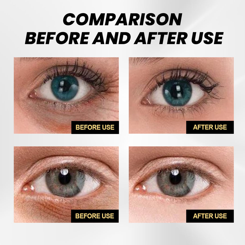 EELHOE Instant Firming Eye Cream for Dark Circles