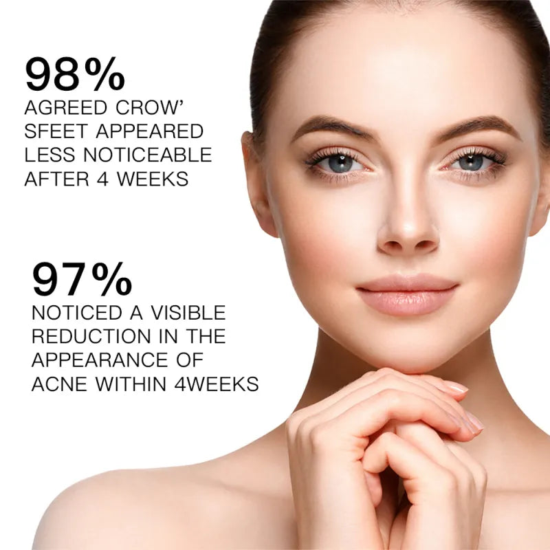 Solución de Retinol para Mejorar el Retinol Facial